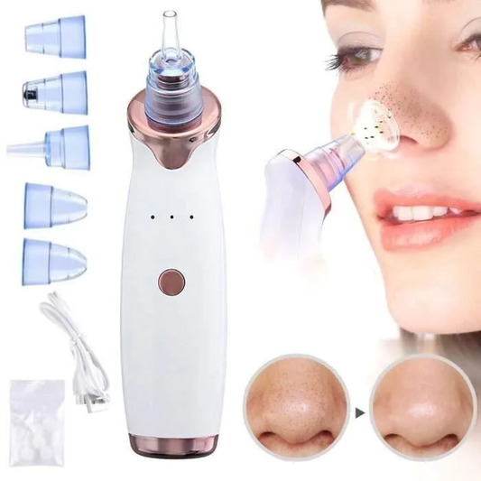 My Little Gifty - Blackhead Vacuum Cleaner Blemish Vacuums